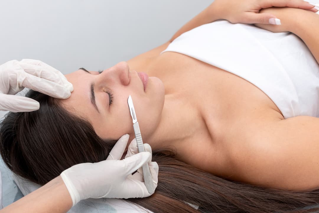 Dermaplaning