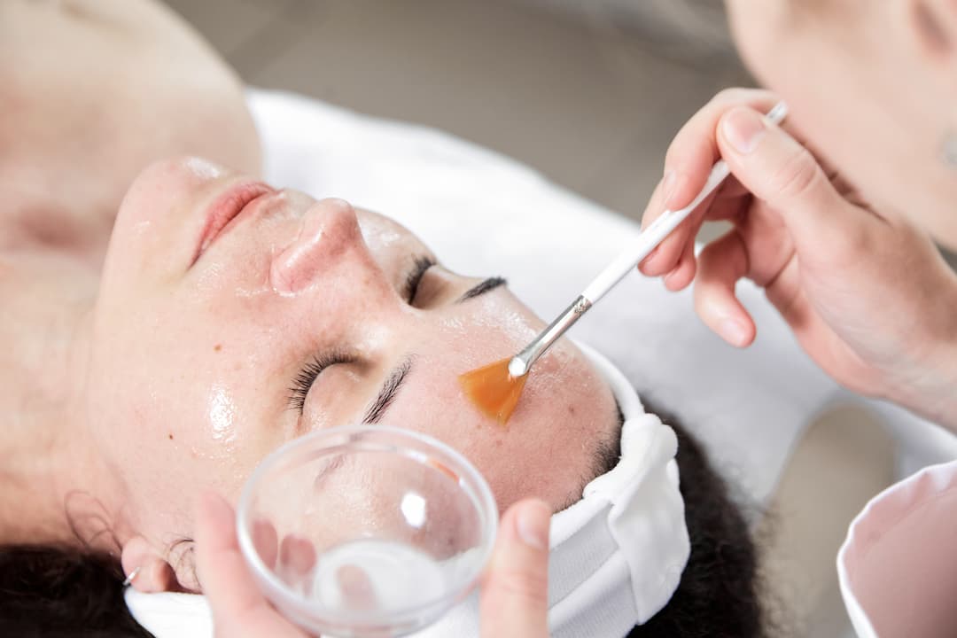 Skin Peel Treatment